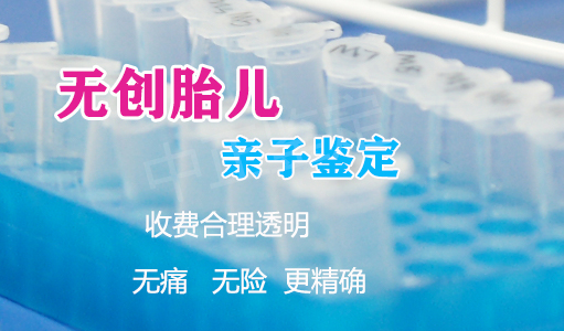 呼和浩特怀孕需要怎么办理亲子鉴定,呼和浩特怀孕亲子鉴定基本的流程 呼和浩特怀孕需要怎么办理亲子鉴定,呼和浩特怀孕亲子鉴定基本的流程
